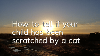 How to tell if your child has been scratched by a cat