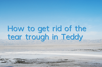 How to get rid of the tear trough in Teddy